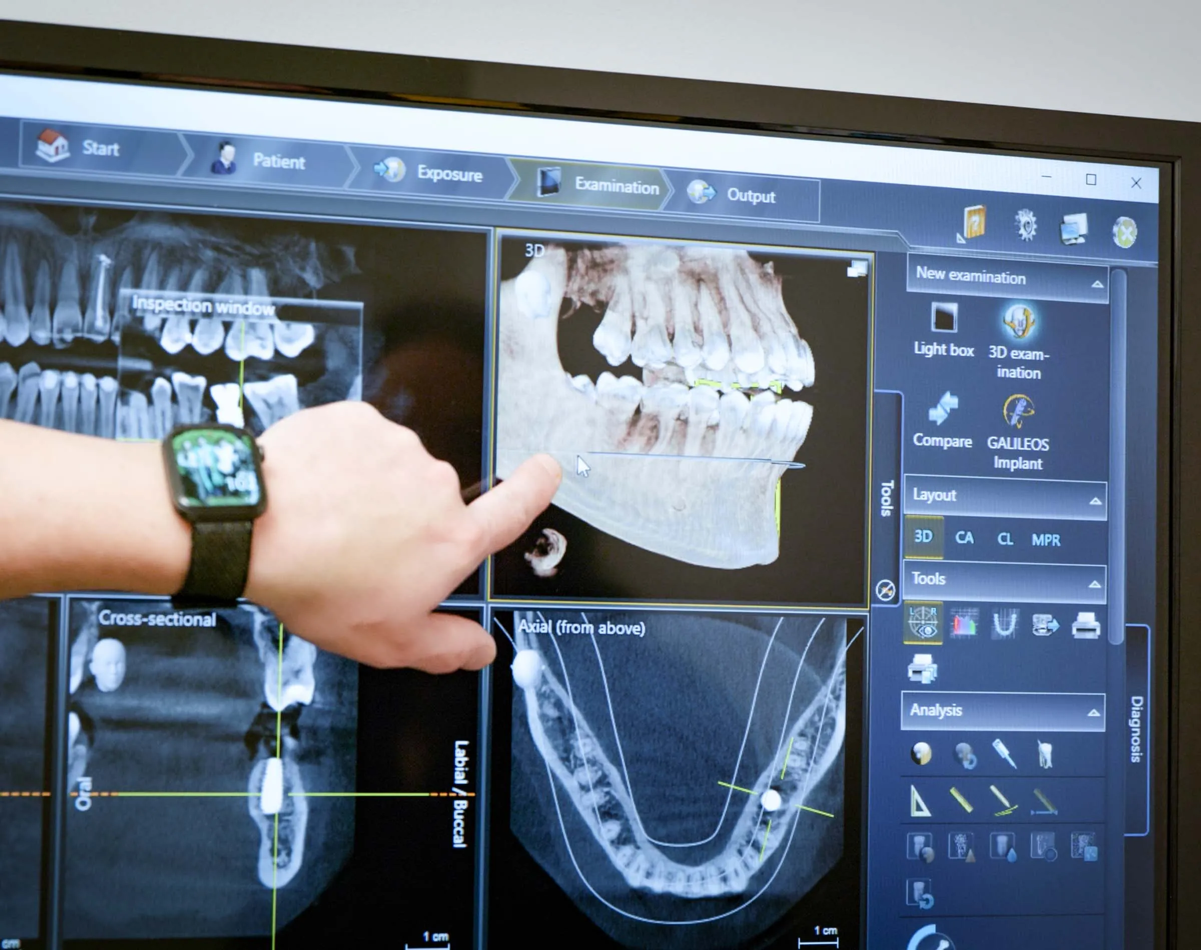 Emergency Root Canal Dentists Shelby And Macomb Townships Mi