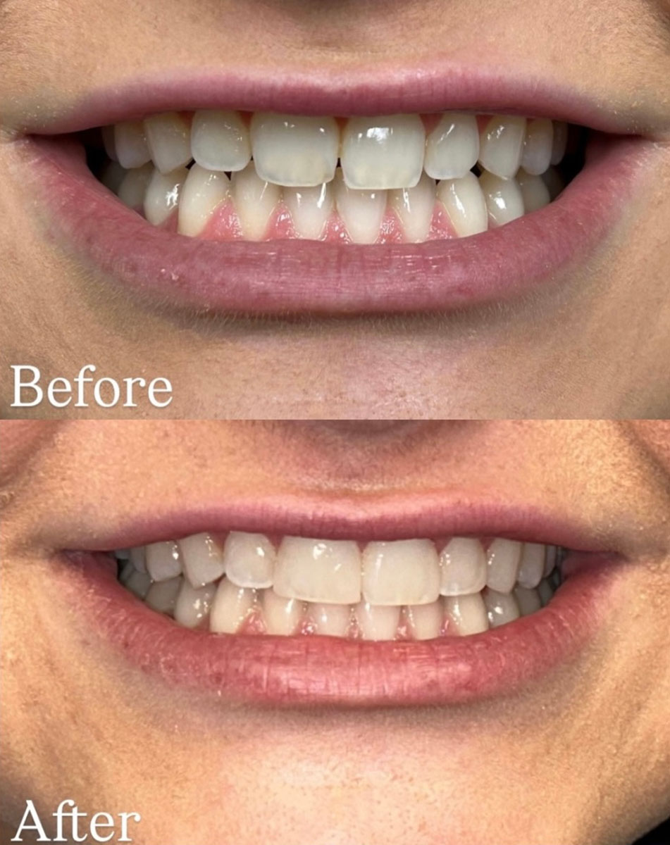 Macomb Township And Shelby Township Cosmetic Dentists