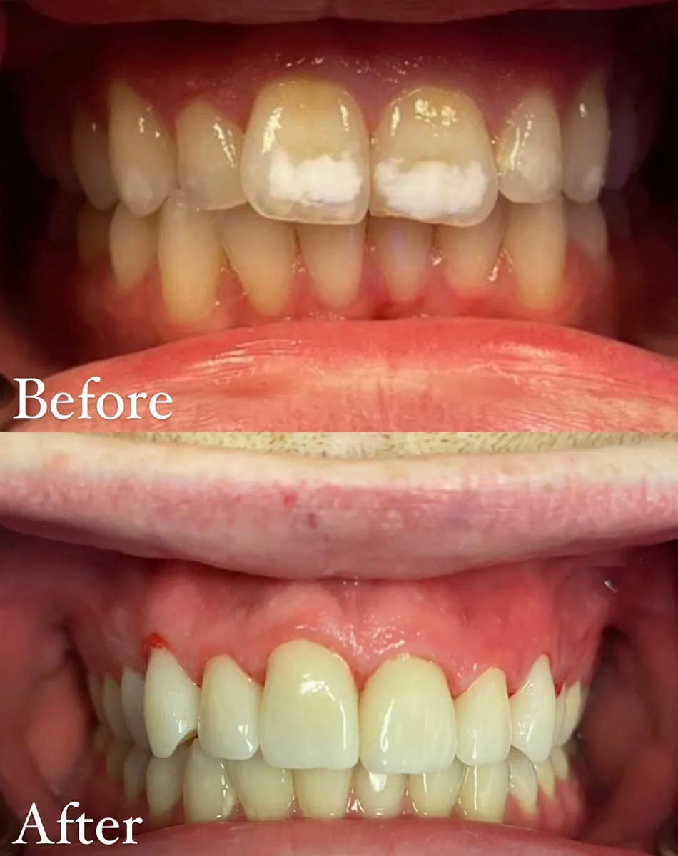 Macomb Township And Shelby Township Dental Implant Dentists