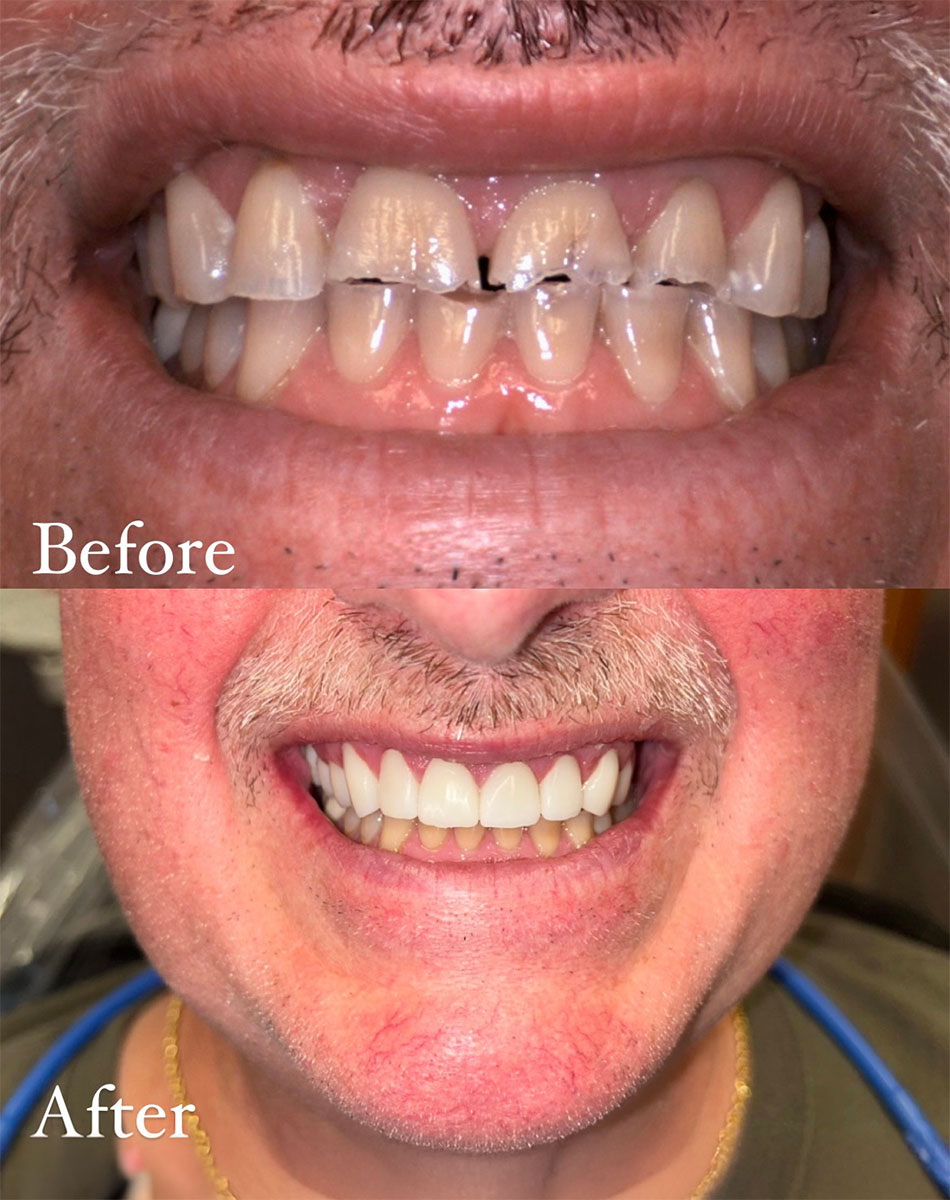 Macomb Township And Shelby Township Preventive Dentists