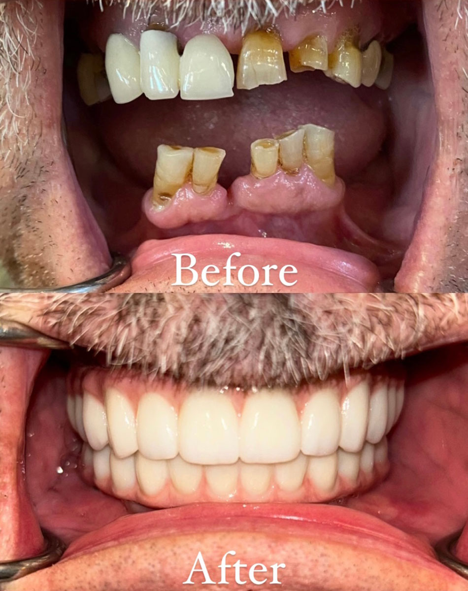 Macomb Township And Shelby Township Restorative Dentists