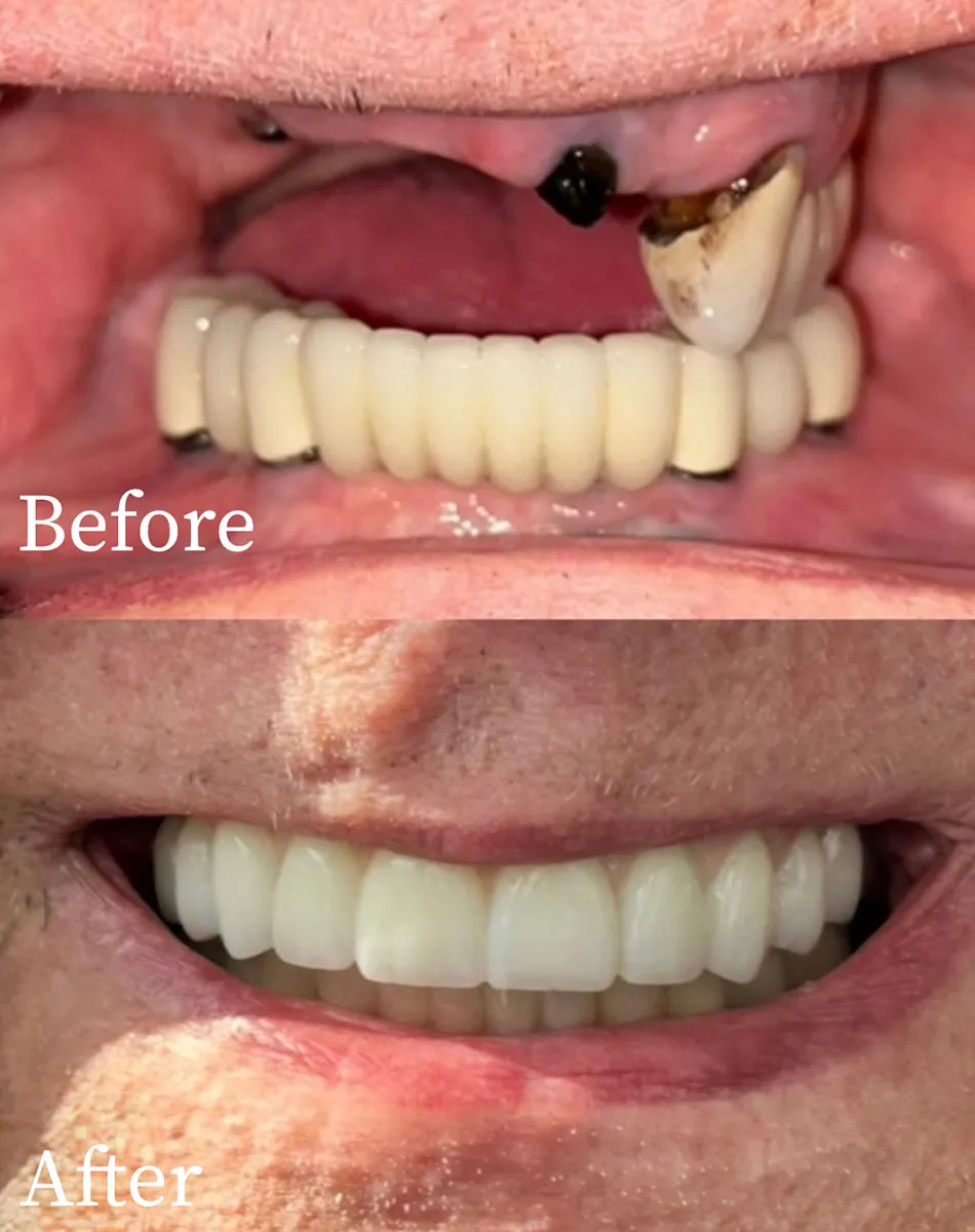 Restorative Dentists Near Me